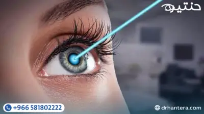 قصة ملهمة في تصحيح الإبصار عندما يتحدى العلم 12 درجة قصر نظر