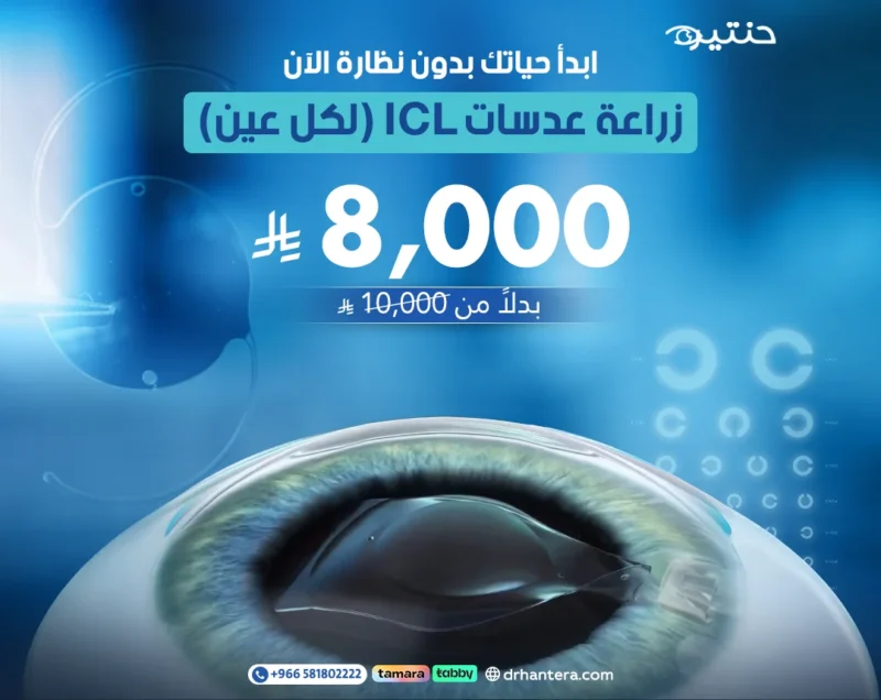زراعة عدسات ICL للعين الواحدة
