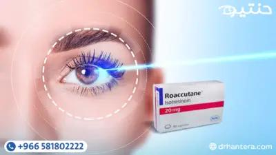 الروكتان وتصحيح الإبصار لماذا نؤجل العملية رغم سلامة الفحوصات؟