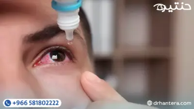 جفاف العين والقطرة المثالية