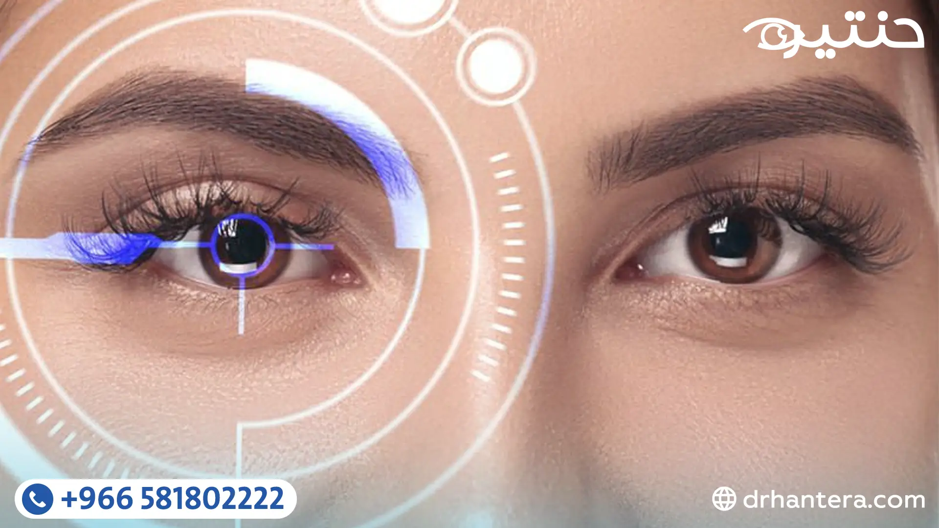 قصة ملهمة في تصحيح الإبصار عندما يتحدى العلم 12 درجة قصر نظر