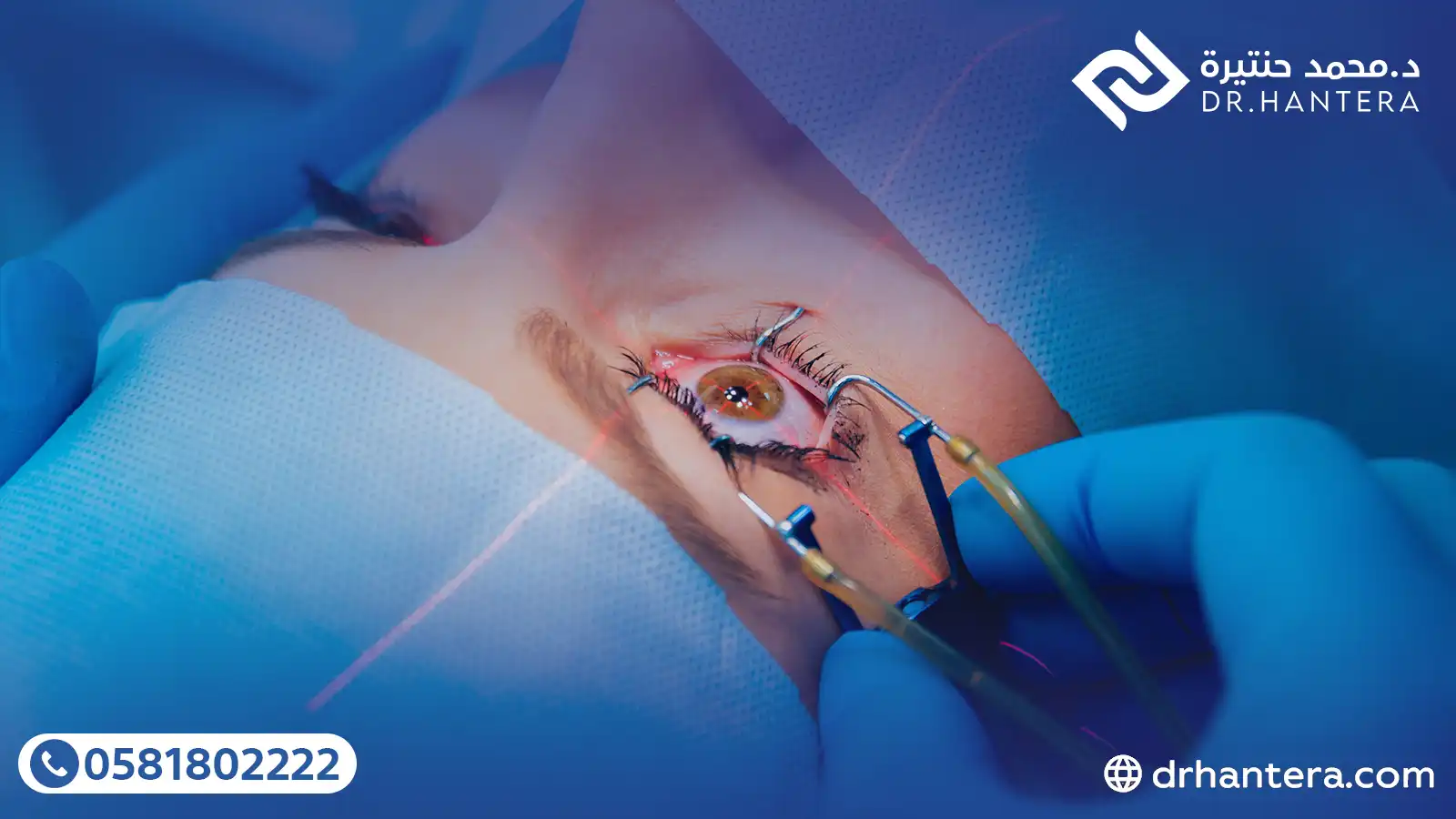 3 حقائق طبية تثبت تفوق أمان الليزك على العدسات اللاصقة مع الدكتور حنتيرة