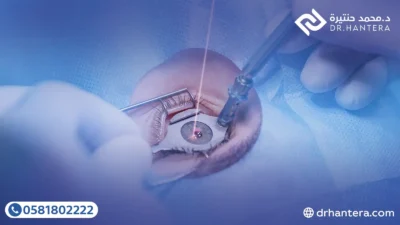 3 حقائق طبية عن ارتفاع ضغط العين بعد عمليات الليزك مع الدكتور حنتيرة