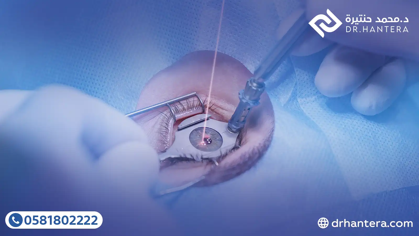 3 حقائق طبية عن ارتفاع ضغط العين بعد عمليات الليزك مع الدكتور حنتيرة