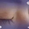 3 حقائق مذهلة عن فوائد الترميش في الوقاية من جفاف العين مع الدكتور حنتيرة
