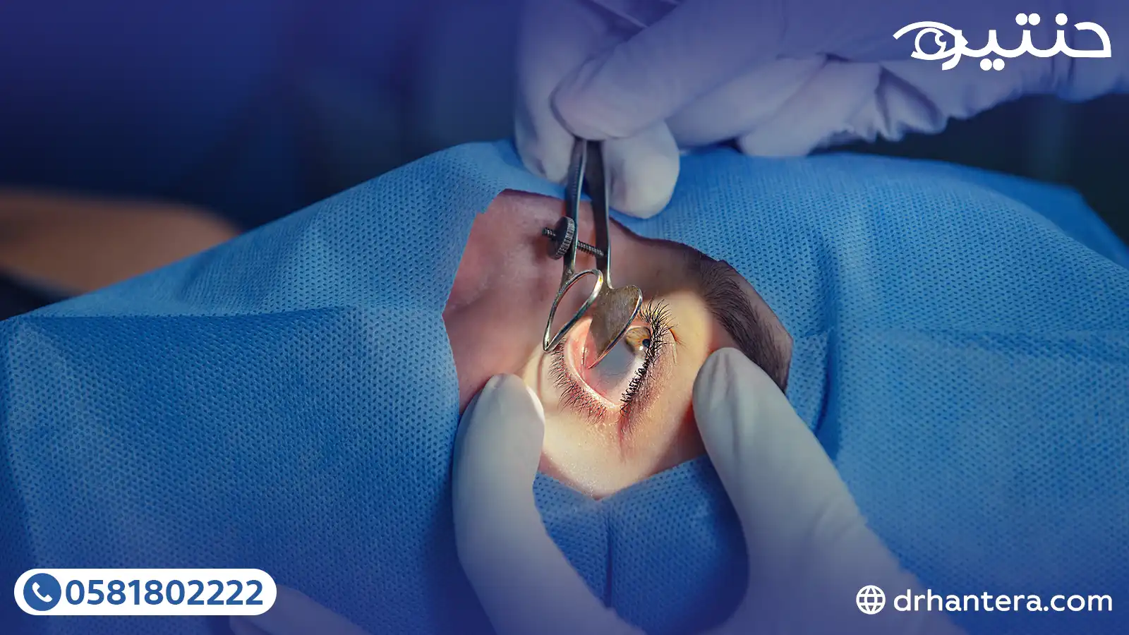 3 نصائح ذهبية بعد عملية المياه البيضاء