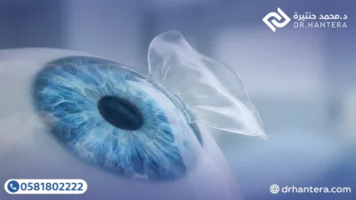 3 نصائح لاستخدام النظارات بعد عمليات الفيمتو ليزك مع الدكتور حنتيرة