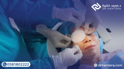 5 تعليمات هامة للتعافي السريع بعد عمليات العيون مع الدكتور حنتيرة