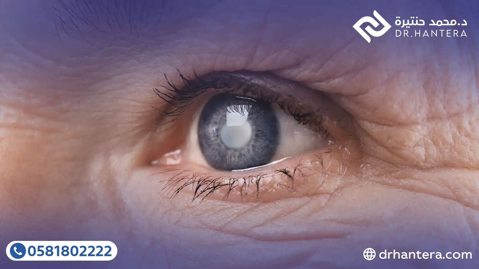 5 حقائق طبية عن مخاطر ارتفاع ضغط العين ومرض الجلوكوما مع الدكتور حنتيرة