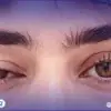 اكتشف الحل النهائي لارتخاء جفن العين
