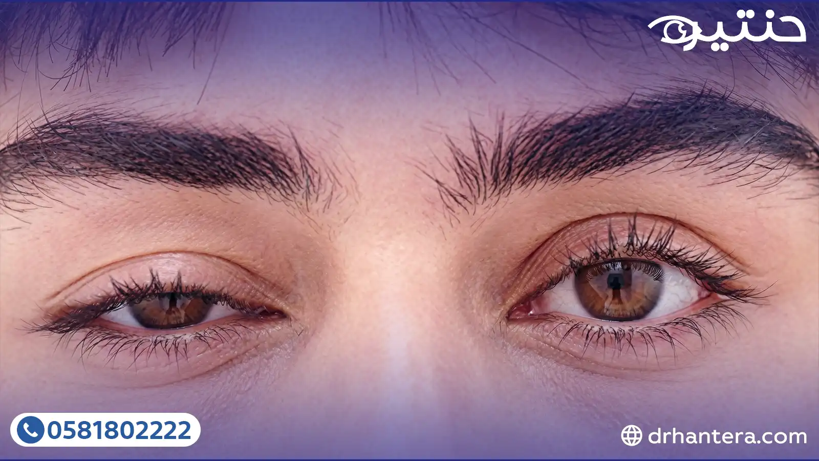 اكتشف الحل النهائي لارتخاء جفن العين
