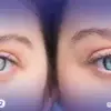 3 حقائق عن المياة البيضاء