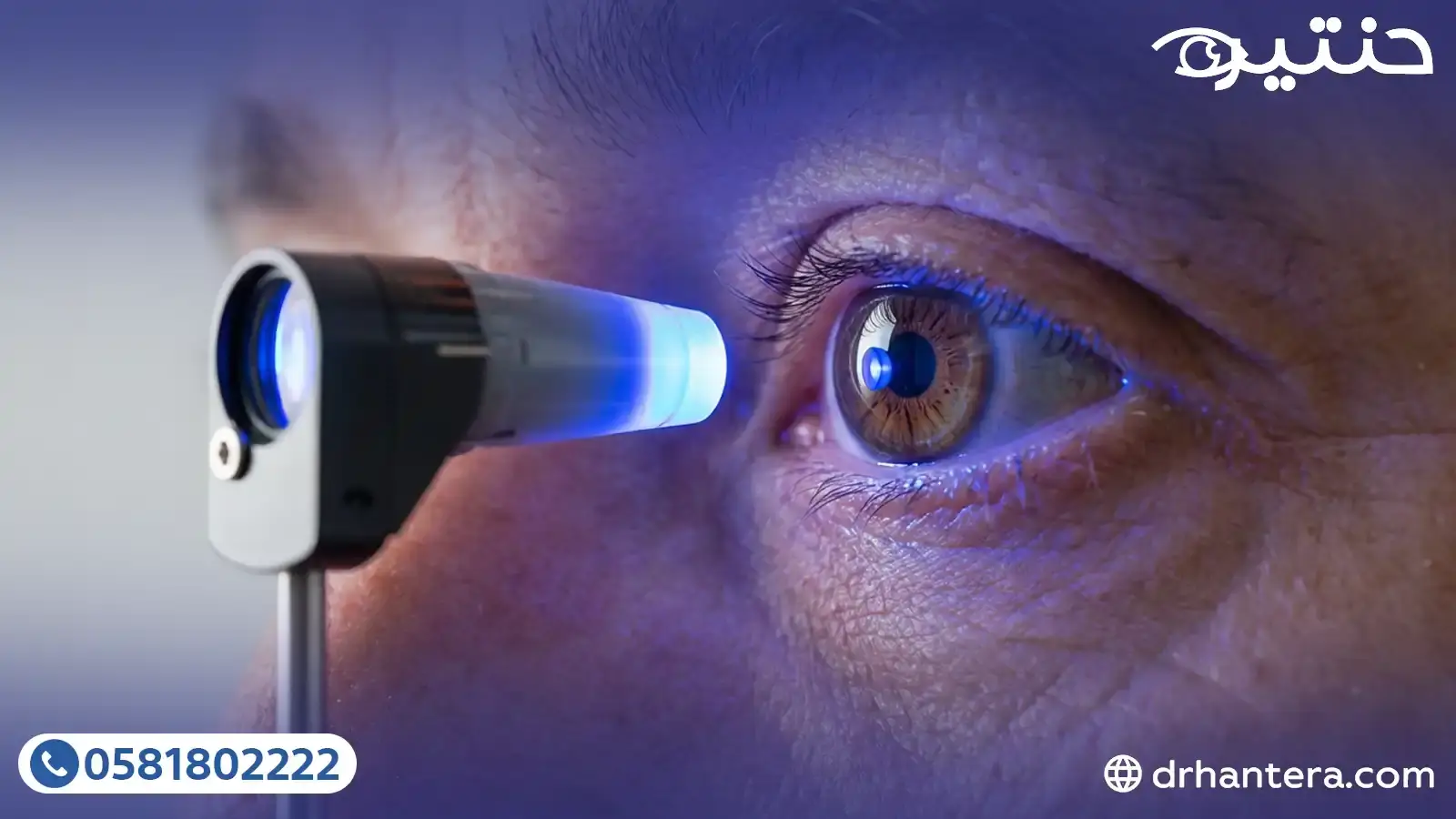 ثورة في علاج المياه الزرقاء (الجلوكوما) 2026