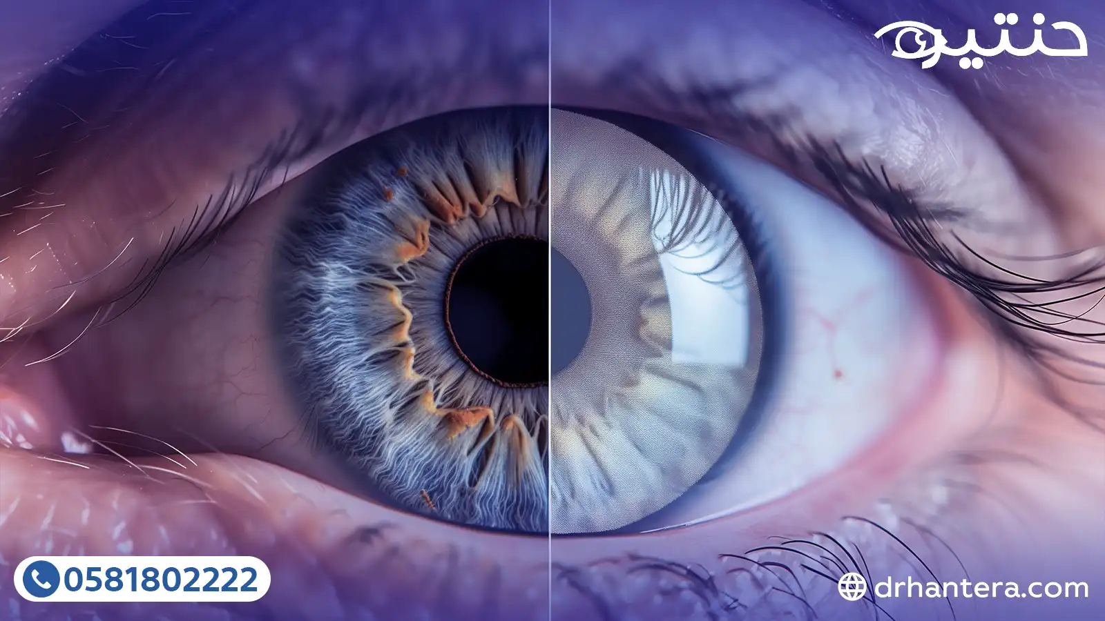 5 أوهام تمنعك من استعادة بصرك