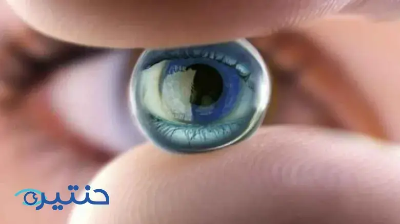 زراعة العدسات متعددة البؤر