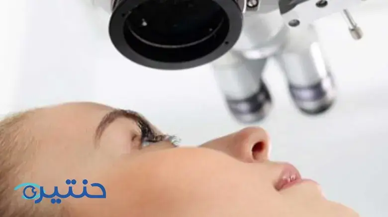عملية الليزك المعدل M-Lasik | الخيار الأمثل لحالات معينة