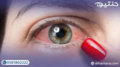 الرئيسية 7 لماذا تعاني من احمرار العين الدائم