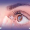 7 أسباب توضح هل العدسات اللاصقة تزيد من جفاف العين