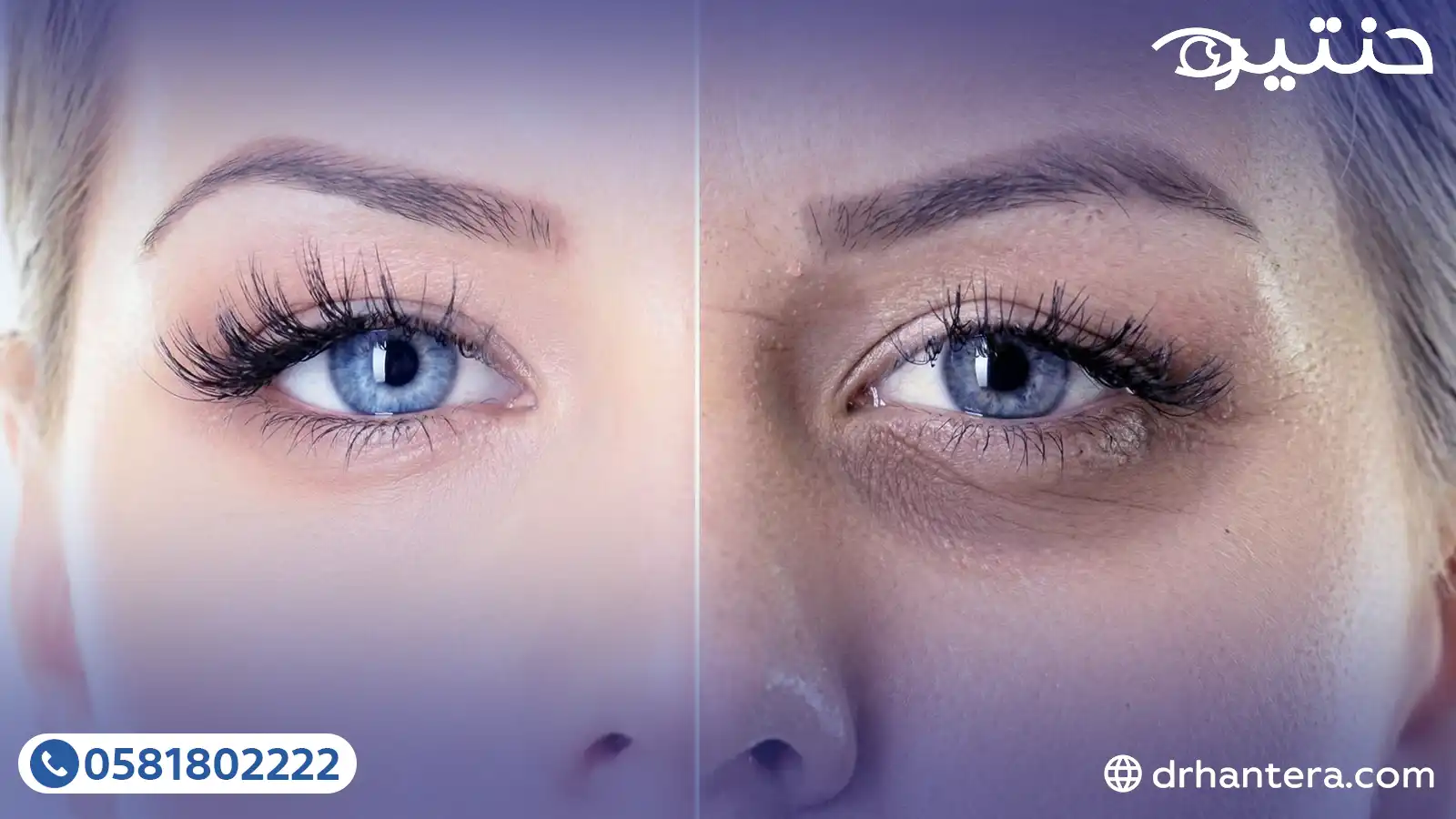 اكتشف الأسباب ال3 الخفية وراء سواد تحت العين