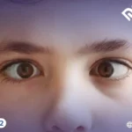 3 فروقات جوهرية بين انحراف القرنية والحول يوضحها الدكتور حنتيرة