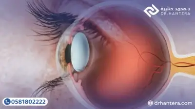 الرئيسية 7 3 نصائح طبية لمرضى زراعة القرنية قبل أخذ التطعيمات مع الدكتور حنتيرة