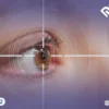 هل يعود ضعف النظر بعد 15 سنة من عملية الليزك؟ توضيح الدكتور حنتيرة