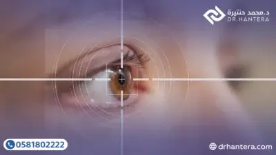 هل يعود ضعف النظر بعد 15 سنة من عملية الليزك؟ توضيح الدكتور حنتيرة